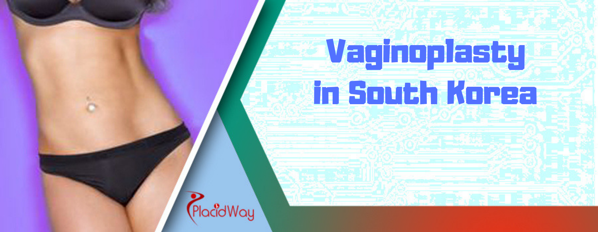 vaginoplasty in south korea